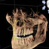 toothworm2012